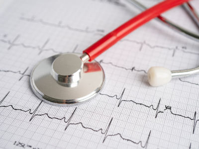 Electrocardiogram monitoring during an acute myocardial infarction.